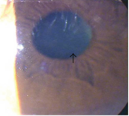 Details are in the caption following the image
