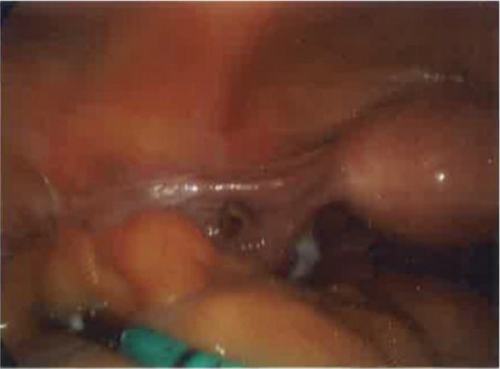 Details are in the caption following the image