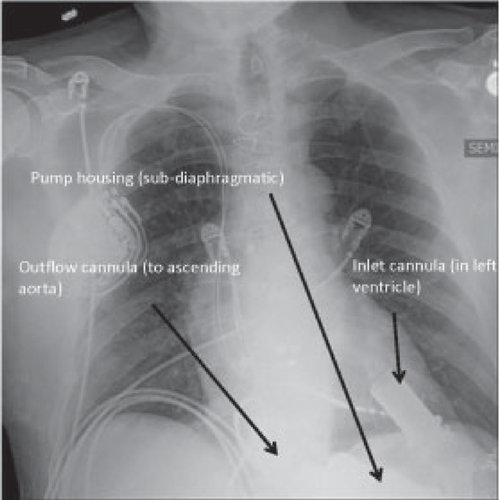 Details are in the caption following the image