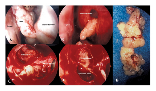 Details are in the caption following the image Details are in the caption following the image