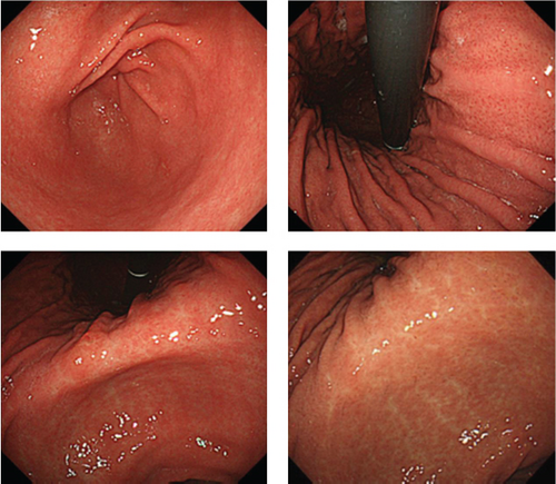 Details are in the caption following the image Details are in the caption following the image