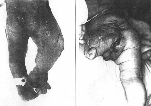 Details are in the caption following the image