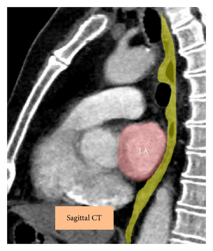 Details are in the caption following the image
