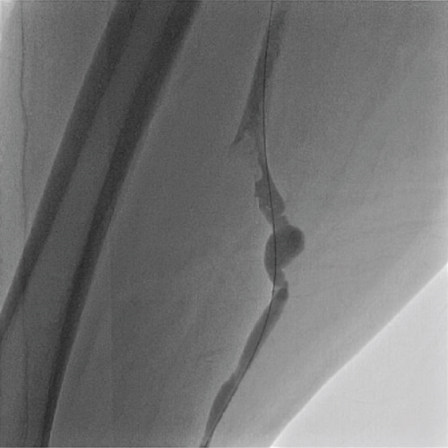 Details are in the caption following the image