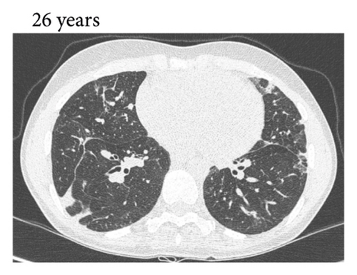 Details are in the caption following the image