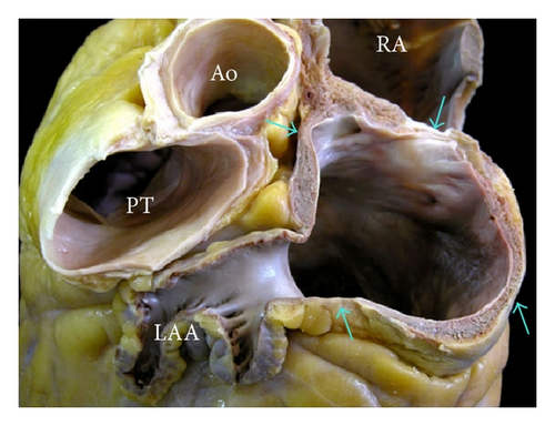 Details are in the caption following the image