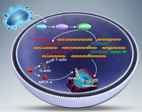 The distinct roles of myosin IIA and IIB under compression stress in nucleus pulposus cells