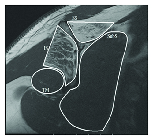 Details are in the caption following the image
