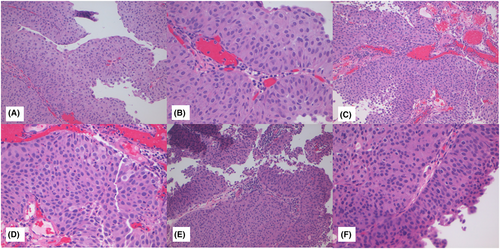 Details are in the caption following the image Details are in the caption following the image