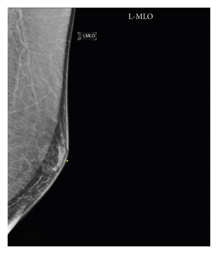 Details are in the caption following the image