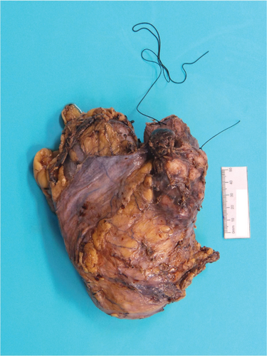 Details are in the caption following the image