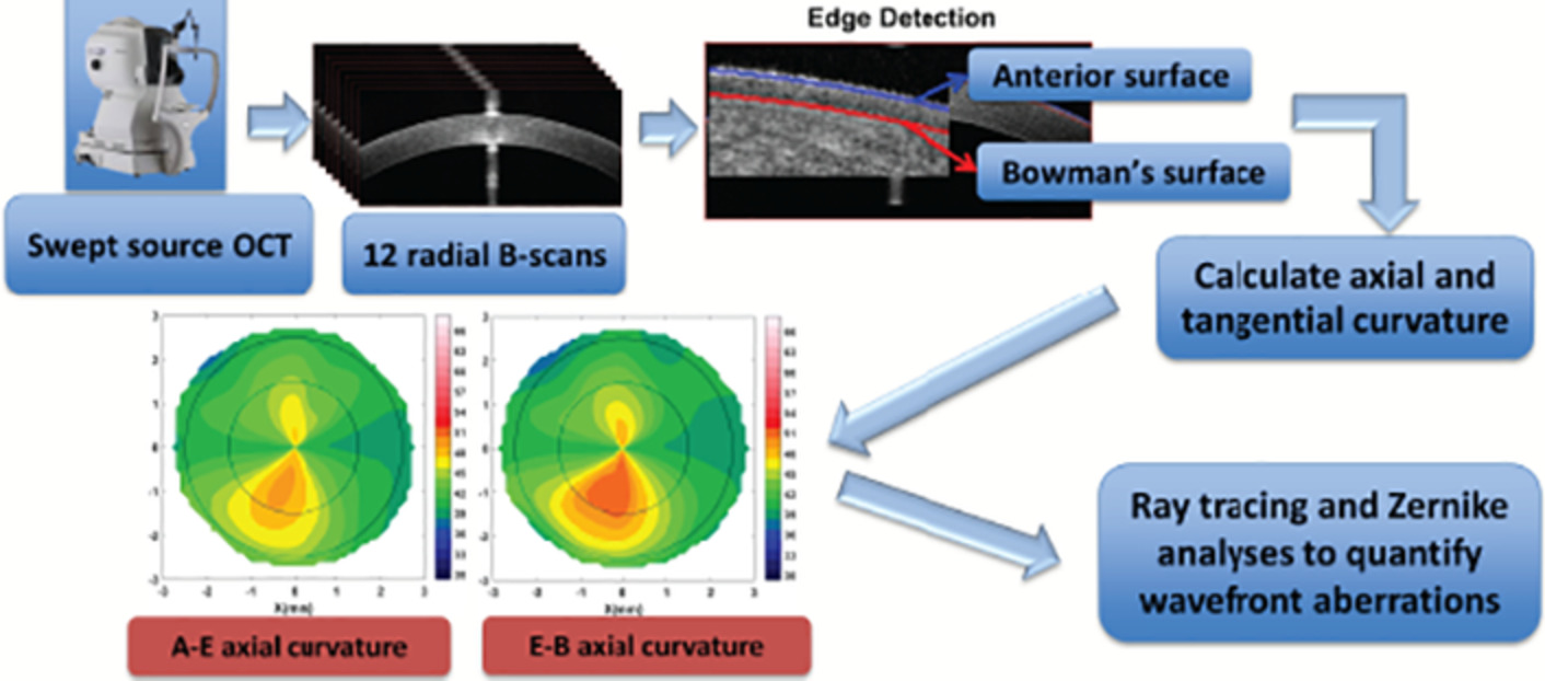 Unique corneal tomography features of allergic eye disease identified by OCT imaging and artificial intelligence