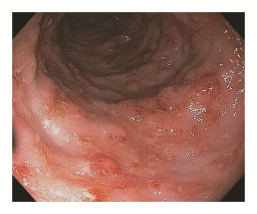 Details are in the caption following the image Details are in the caption following the image