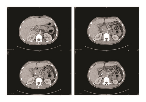 Details are in the caption following the image Details are in the caption following the image