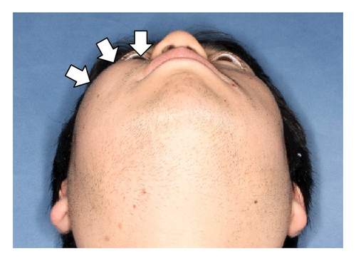 Details are in the caption following the image