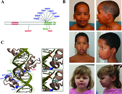 Clinical and functional characterization of two novel ZBTB20 mutations causing Primrose syndrome