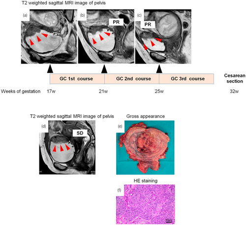 Details are in the caption following the image Details are in the caption following the image