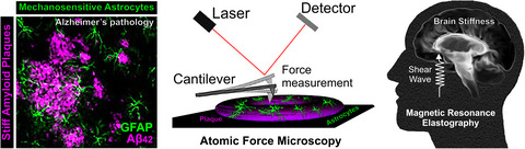 Mechanobiology of the brain in ageing and Alzheimer's disease