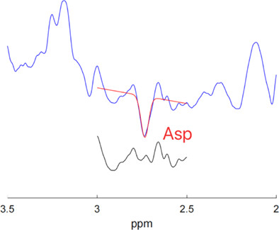 Changes in aspartate metabolism in the medial-prefrontal cortex of nicotine addicts based on J-edited magnetic resonance spectroscopy