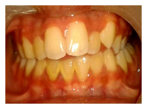 Details are in the caption following the image Details are in the caption following the image