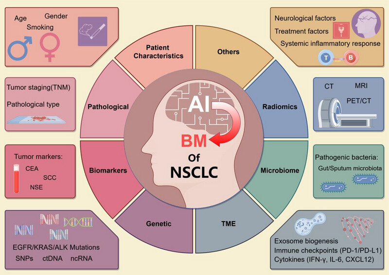 Brain metastasis in non-small cell lung cancer: High-risk factors and predictive models Issue ,