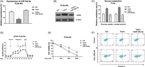 Influences of the lncRNA TUG1-miRNA-34a-5p network on fibroblast-like synoviocytes (FLSs) dysfunction in rheumatoid arthritis through targeting the lactate dehydrogenase A (LDHA)