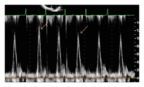 Details are in the caption following the image Details are in the caption following the image