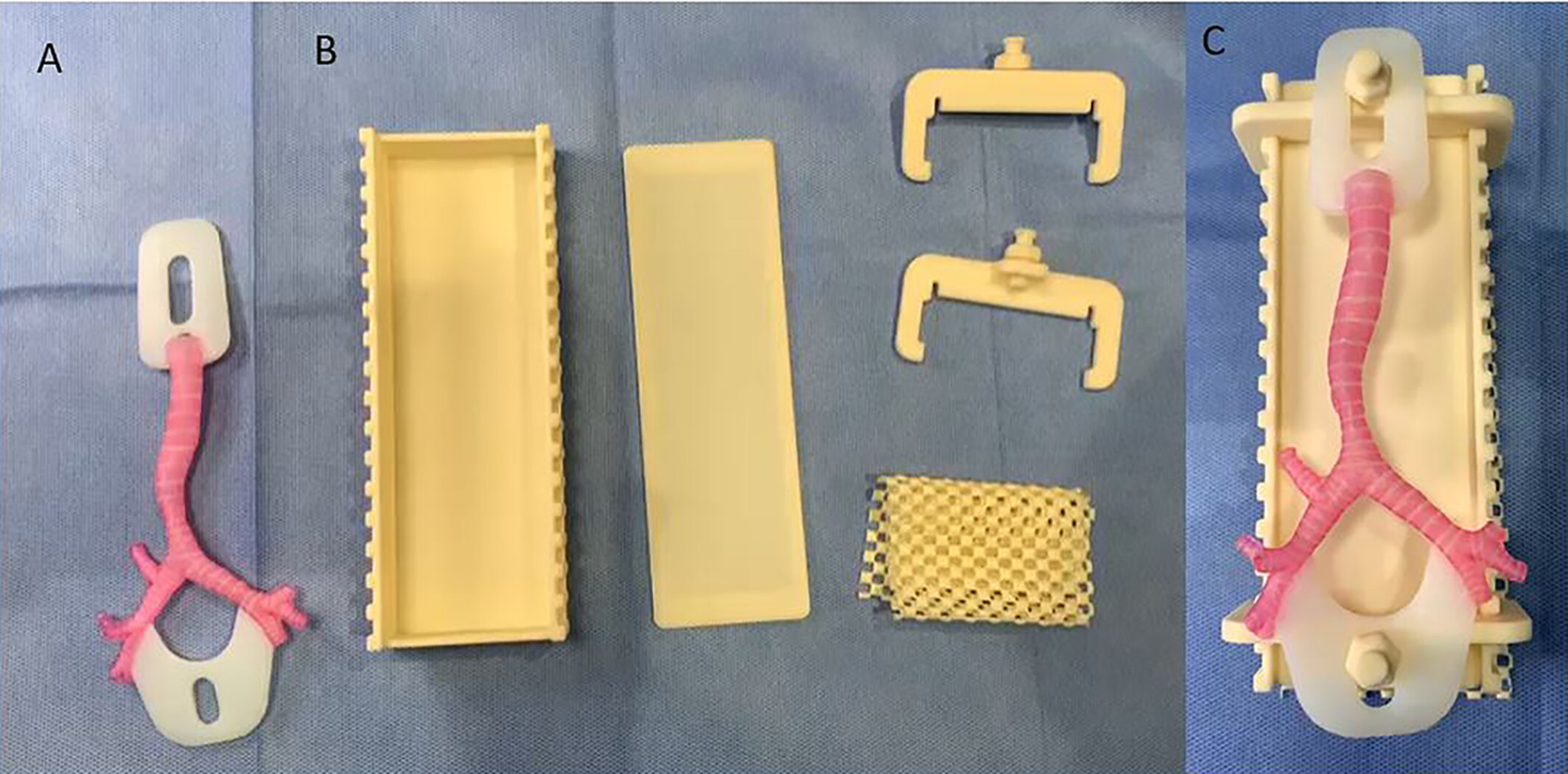 Creating Patient-Specific 3D-Printed Airway Models for Slide Tracheoplasty