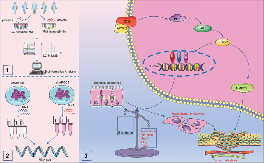 Apolipoprotein C-II induces EMT to promote gastric cancer peritoneal metastasis via PI3K/AKT/mTOR pathway