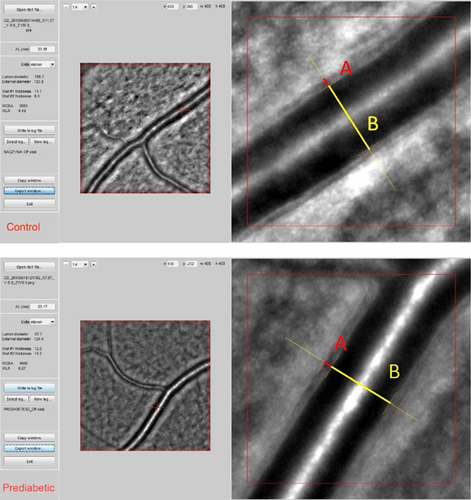 Details are in the caption following the image Details are in the caption following the image