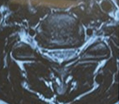 Details are in the caption following the image
