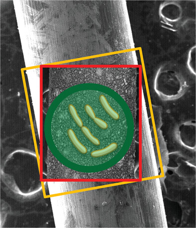 Smart Design of Sensor-Coated Surgical Sutures for Bacterial Infection Monitoring