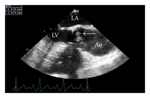 Details are in the caption following the image