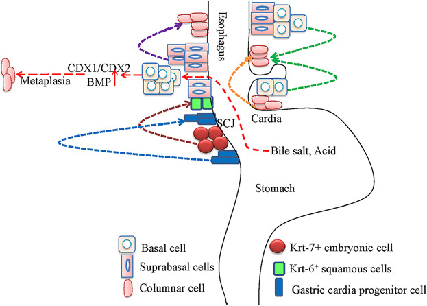 Basal progenitor cells bridge the development, malignant cancers, and multiple diseases of esophagus