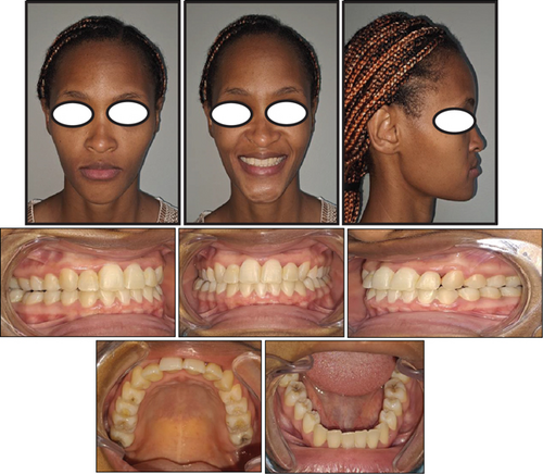 Details are in the caption following the image Details are in the caption following the image