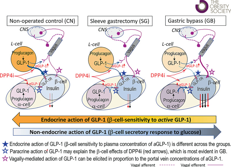 Differential effect of gastric bypass versus sleeve gastrectomy on insulinotropic action of endogenous incretins