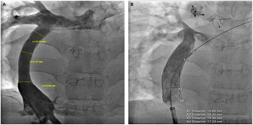 Details are in the caption following the image Details are in the caption following the image