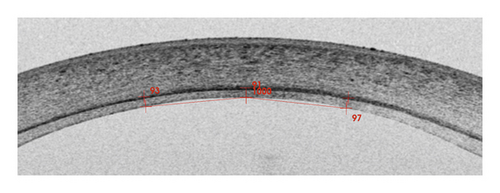 Details are in the caption following the image