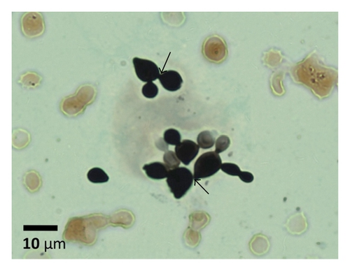 Details are in the caption following the image