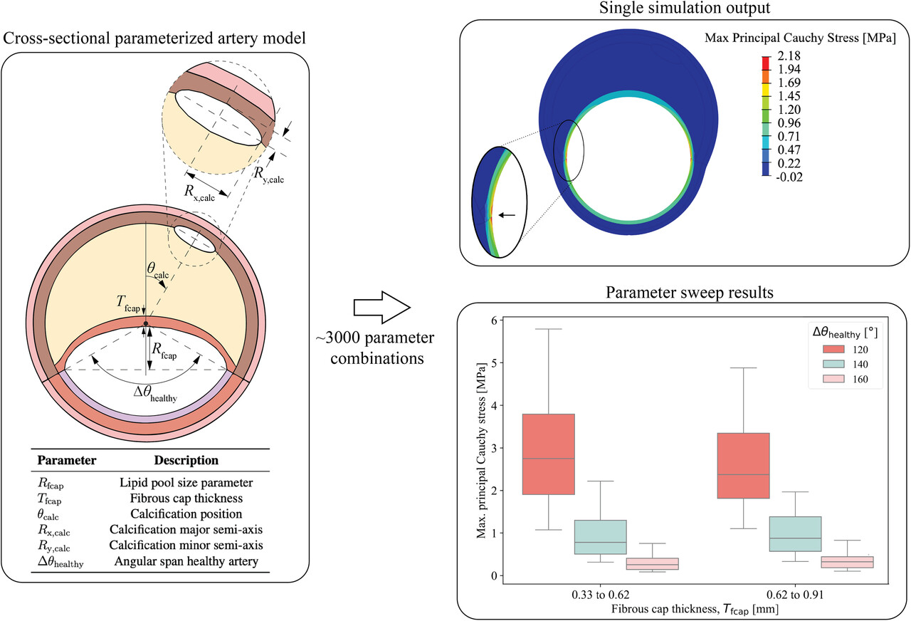 A Parameterized Cross-Sectional Model for Simulating Balloon Angioplasty in Atherosclerotic Arteries Issue 7, 2025