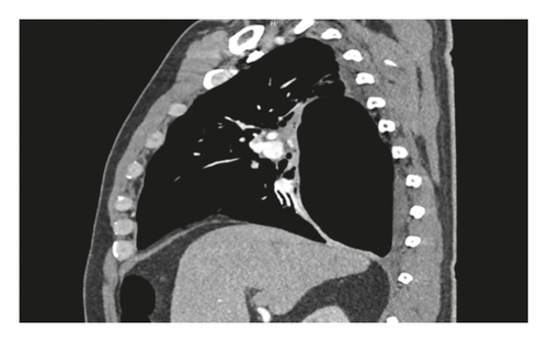 Details are in the caption following the image