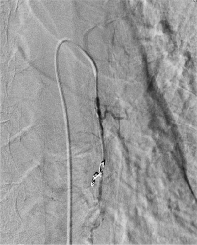 Details are in the caption following the image