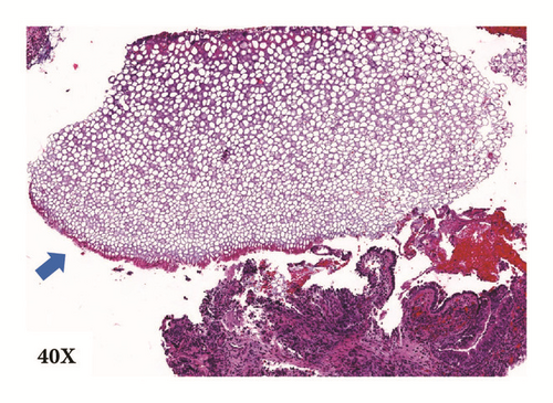 Details are in the caption following the image