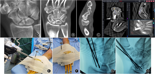 Details are in the caption following the image Details are in the caption following the image