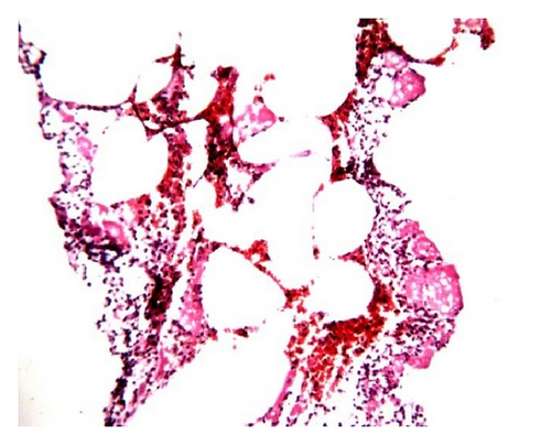 Details are in the caption following the image