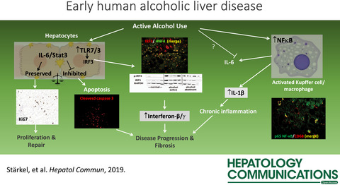 Deficient IL-6/Stat3 Signaling, High TLR7, and Type I Interferons in Early Human Alcoholic Liver Disease: A Triad for Liver Damage and Fibrosis