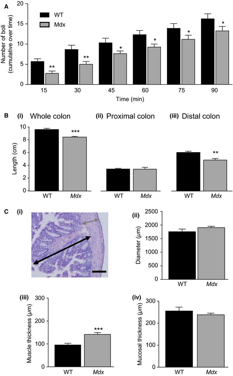 In vivo neutralization of IL-6 receptors ameliorates gastrointestinal dysfunction in dystrophin-deficient mdx mice