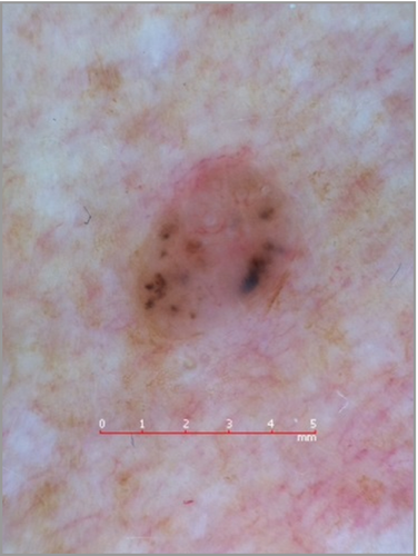 Details are in the caption following the image Details are in the caption following the image