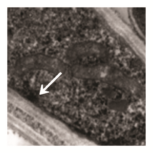 Details are in the caption following the image