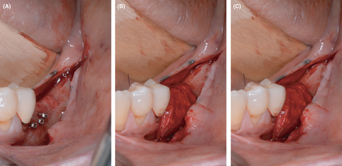 Details are in the caption following the image Details are in the caption following the image